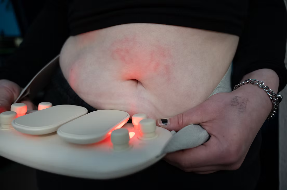 Willow displaying the heat scars his heating pad leaves him with.